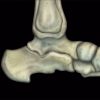 MRIOnline MRI Mastery Series: Ankle 2017 (Videos)