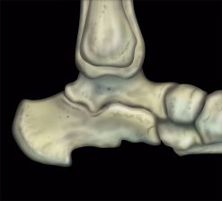 MRIOnline MRI Mastery Series: Ankle 2017 (Videos)