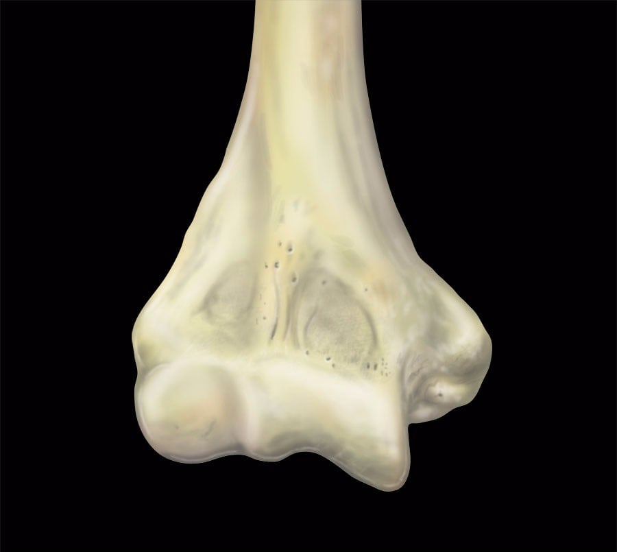 MRIOnline MRI Mastery Series Elbow 2021 (Videos)