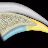 MRIOnline MRI Mastery Series: Hip 2021 (Videos)
