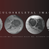 Musculoskeletal Imaging 2020 (Videos)