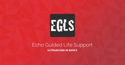 ECHO-Guided Life Support Using ultrasound to categorise shock and guide initial management (Videos)