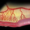 MRIOnline Imaging Mastery Series Crohn’s Disease 2021 (Videos)