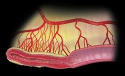 MRIOnline Imaging Mastery Series Crohn’s Disease 2021 (Videos)