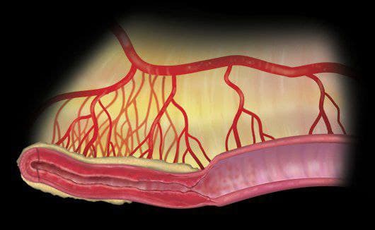 MRIOnline Imaging Mastery Series Crohn’s Disease 2021 (Videos)
