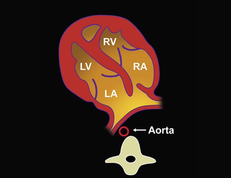 MRIOnline Imaging Mastery Series: Fetal Heart and Great Vessel Evaluation 2021 (Videos)