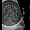 MRIOnline Imaging Mastery Series: High Risk Screening Breast MRI 2021 (Videos)