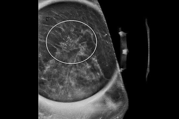 MRIOnline Imaging Mastery Series: High Risk Screening Breast MRI 2021 (Videos)