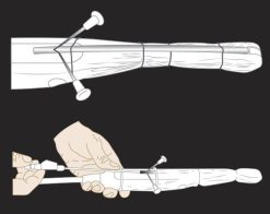 MRIOnline Imaging Mastery Series: Image-Guided Abscess Drainage in Interventional Radiology 2021 (Videos)