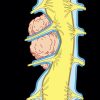 MRIOnline MRI Mastery Series: Extradural Lesions 2020 (Videos)