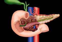 MRIOnline Imaging Mastery Series Pancreas Imaging 2021 (Videos)