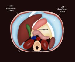 MRIOnline Imaging Mastery Series: Peritoneum and Mesentery 2021 (Videos)