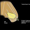 MRIOnline Imaging Mastery Series: Regulatory/Standards of Care in Breast Imaging 2021 (Videos)