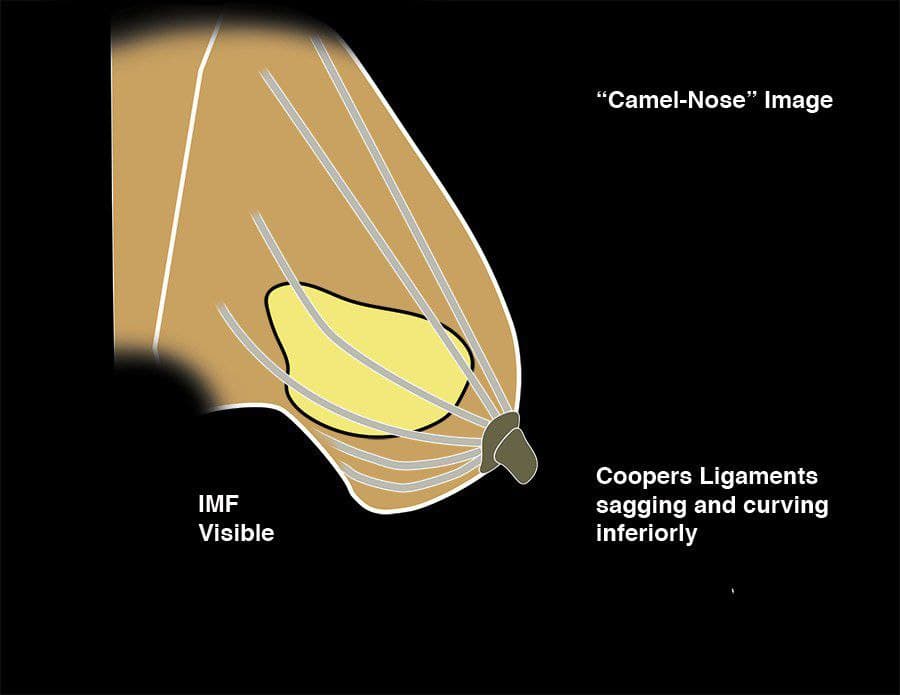 MRIOnline Imaging Mastery Series: Regulatory/Standards of Care in Breast Imaging 2021 (Videos)