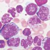 Hematopathology 2021 (Videos)