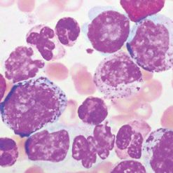 Hematopathology 2021 (Videos)