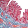 Current Topics in Gastrointestinal and Liver Pathology 2022 (Videos)
