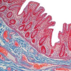 Current Topics in Gastrointestinal and Liver Pathology 2022 (Videos)