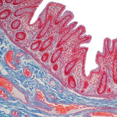Current Topics in Gastrointestinal and Liver Pathology 2022 (Videos)