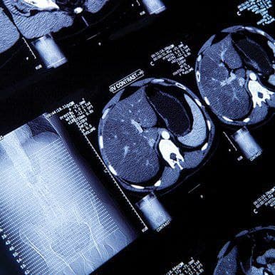 NYU Langone’s Head to Toe Imaging 2022 (Videos)
