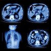 UCSF Abdominal and Thoracic Imaging 2022 (Videos)