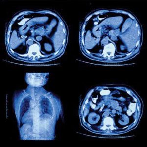 UCSF Abdominal and Thoracic Imaging 2022 (Videos)