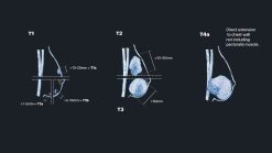 MRIOnline Mastery Series: Evaluation of Newly Diagnosed, Pre-Operative Breast Cancer Patients 2021 (Videos)