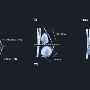 MRIOnline Mastery Series: Evaluation of Newly Diagnosed, Pre-Operative Breast Cancer Patients 2021 (Videos)