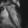 MRIOnline Mastery Series: Cardiac MRI of Non-Ischemic Cardiomyopathy 2021 (Videos)