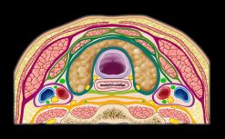 MRIOnline Mastery Series: The Carotid Space 2021 (Videos)
