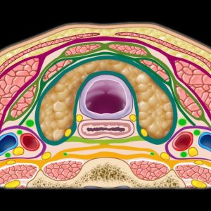 MRIOnline Mastery Series: The Carotid Space 2021 (Videos)