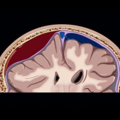 MRIOnline Emergency Series: Emergency Neuroimaging: Brain 2021 (Videos)
