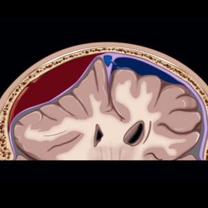MRIOnline Emergency Series: Emergency Neuroimaging: Brain 2021 (Videos)