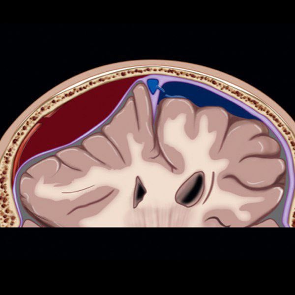 MRIOnline Emergency Series: Emergency Neuroimaging: Brain 2021 (Videos)