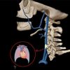 MRIOnline Emergency Series: Emergency Neuroimaging: Head, Neck & Spine 2021 (Videos)