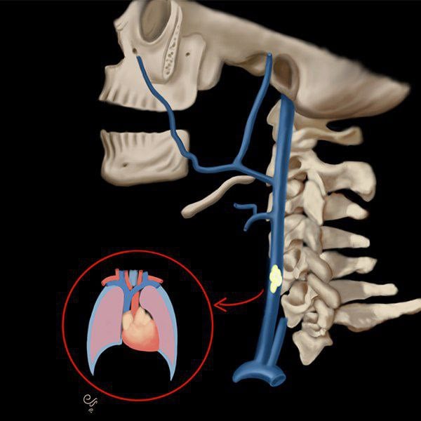 MRIOnline Emergency Series: Emergency Neuroimaging: Head, Neck & Spine 2021 (Videos)