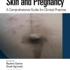 Skin and Pregnancy: A Comprehensive Guide for Clinical Practice (Original PDF from Publisher)