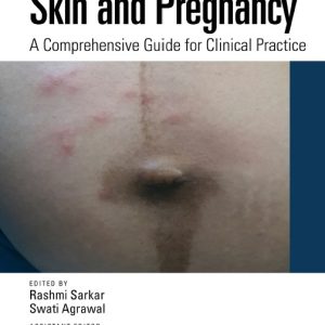 Skin and Pregnancy: A Comprehensive Guide for Clinical Practice (Original PDF from Publisher)