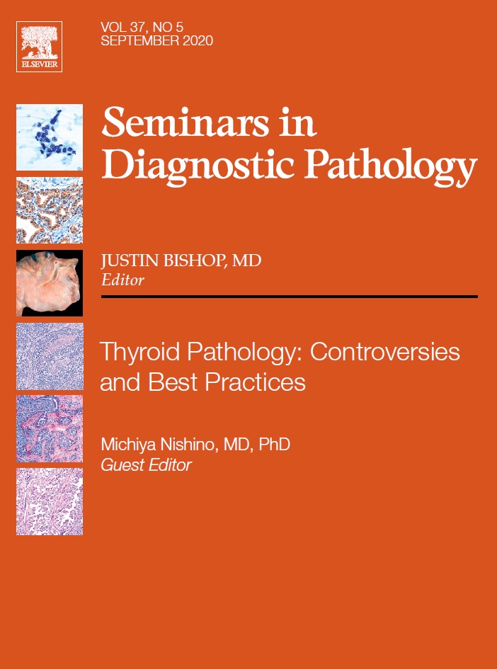 Seminars in Diagnostic Pathology VOL 37 , NO 5 SEPTEMBER 2020 (True PDF)