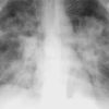 MRIOnline Imaging Mastery Series: Cardiopulmonary Imaging 2021 (Videos)