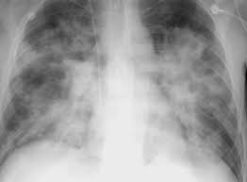 MRIOnline Imaging Mastery Series: Cardiopulmonary Imaging 2021 (Videos)