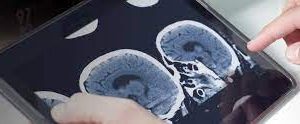 Neuroradiology Update 2016 – Online (Videos)