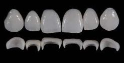 Gidedental Prosthetic Rehabilitation on Natural Teeth – Predictable, Esthetic and Systematic Steps 2020 (Videos)