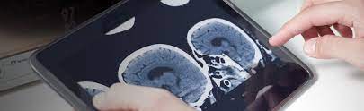 Neuroradiology Update 2016 – Online (Videos)