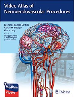 Video Atlas of Neuroendovascular Procedures (Original PDF + VIDEOS )