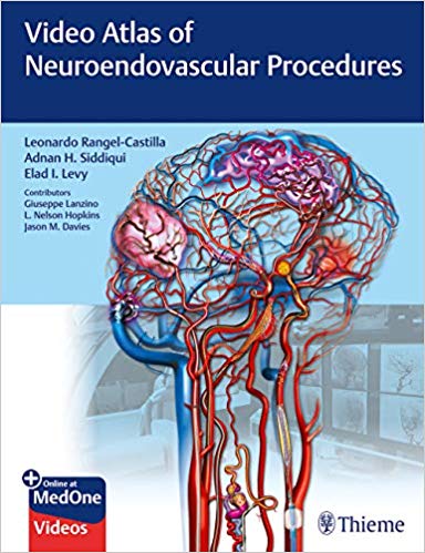 Video Atlas of Neuroendovascular Procedures (Original PDF + VIDEOS )