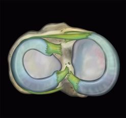MRIOnline MRI Mastery Series: Knee 2021 (Videos)