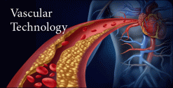 Vascular Technology Review 2022 (Videos)