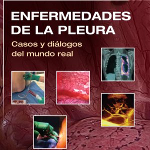 Enfermedades de la pleura Casos y diálogos del mundo real (True PDF)