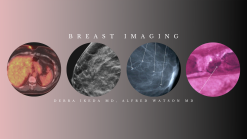 Breast Imaging (BUNDLE) – Debra Ikeda M.D., Alfred Watson M.D 2020 (Videos)